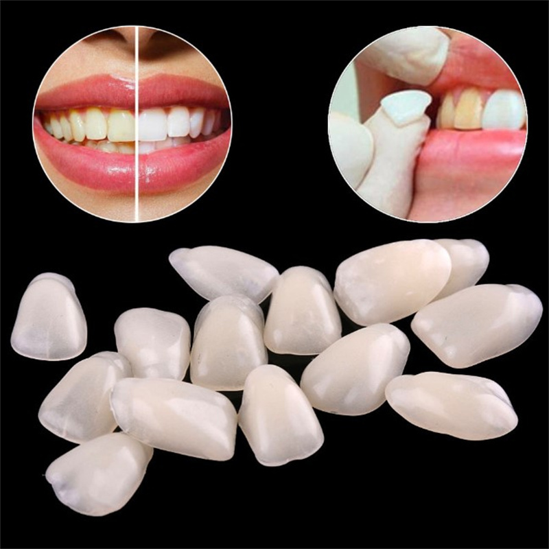 Teeth Whitening Veneers - Temporary Dental Veneers - Ultra-Thin Resin