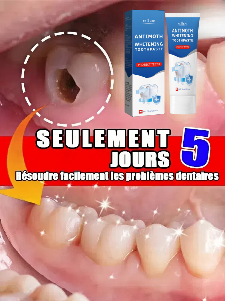 Teeth Whitening Effective - 2025 Remove Cavities Effective Teeth Whitening