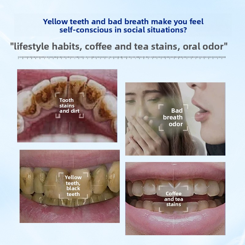 Enzyme Brightening and Whiteni - Teeth Whitening Enzymes recension och pris