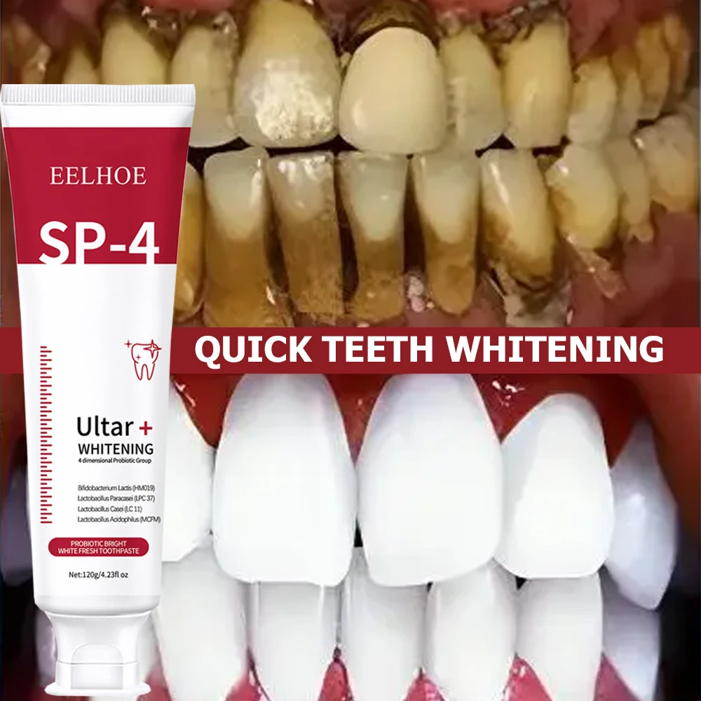 5pcs Sp-4 120g Probiotic White - Teeth Whitening Enzymes recension och pris