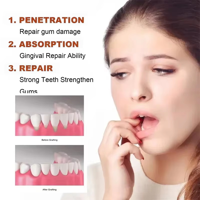 Rapid Repair Gums Serum Effect - Teeth Whitening Foam recension och pris