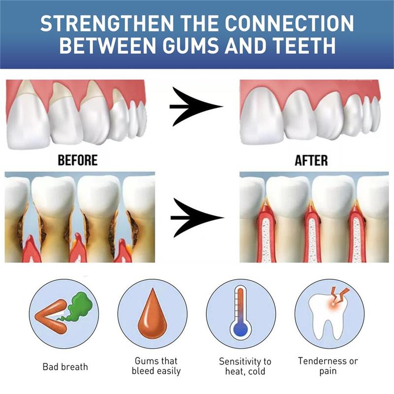 Rapid Repair Gums Serum Effect - Teeth Whitening Foam recension och pris