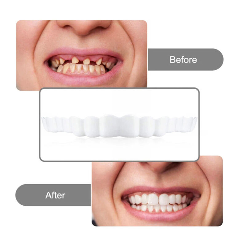 4-6 Pairs Upper&Lower Jaw Dent - Teeth Whitening Mask recension och pris