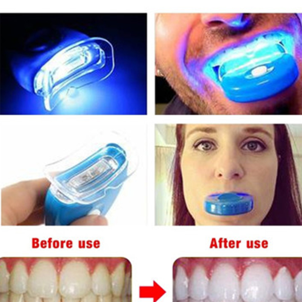 New Blue Led Teeth Whitening A - Teeth Whitening With Laser recension och pris
