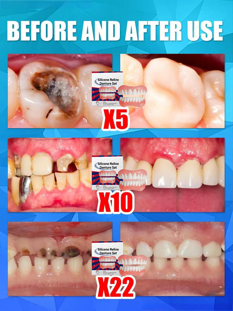 False Teeth Silicone Upper Low - Teeth Whitening Veneers recension och pris