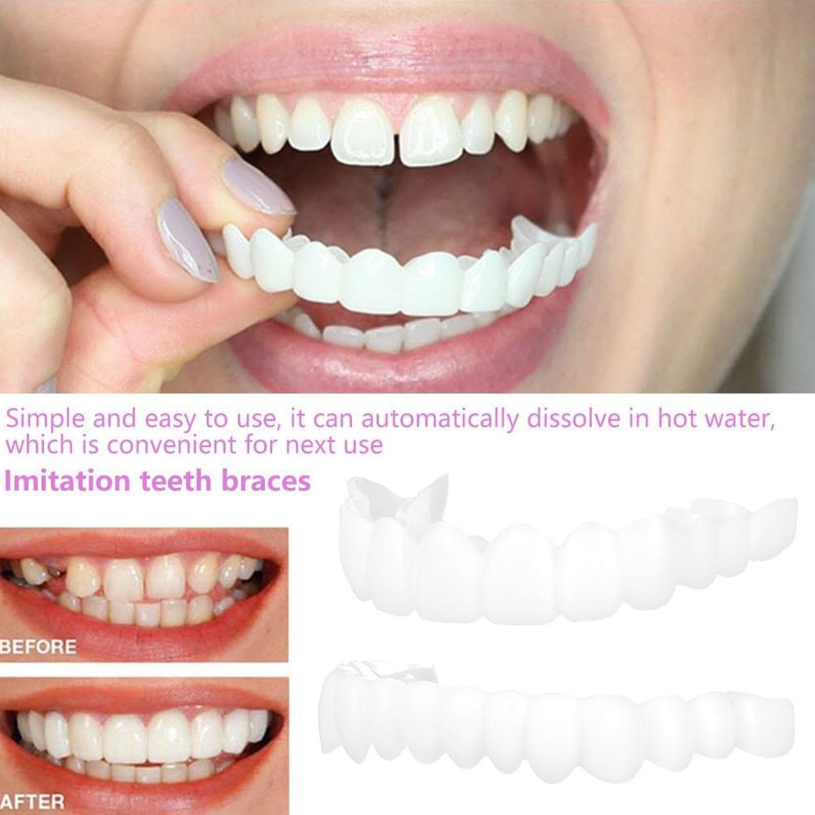 2pcs Men Women Temporary Teeth - Teeth Whitening Veneers recension och pris