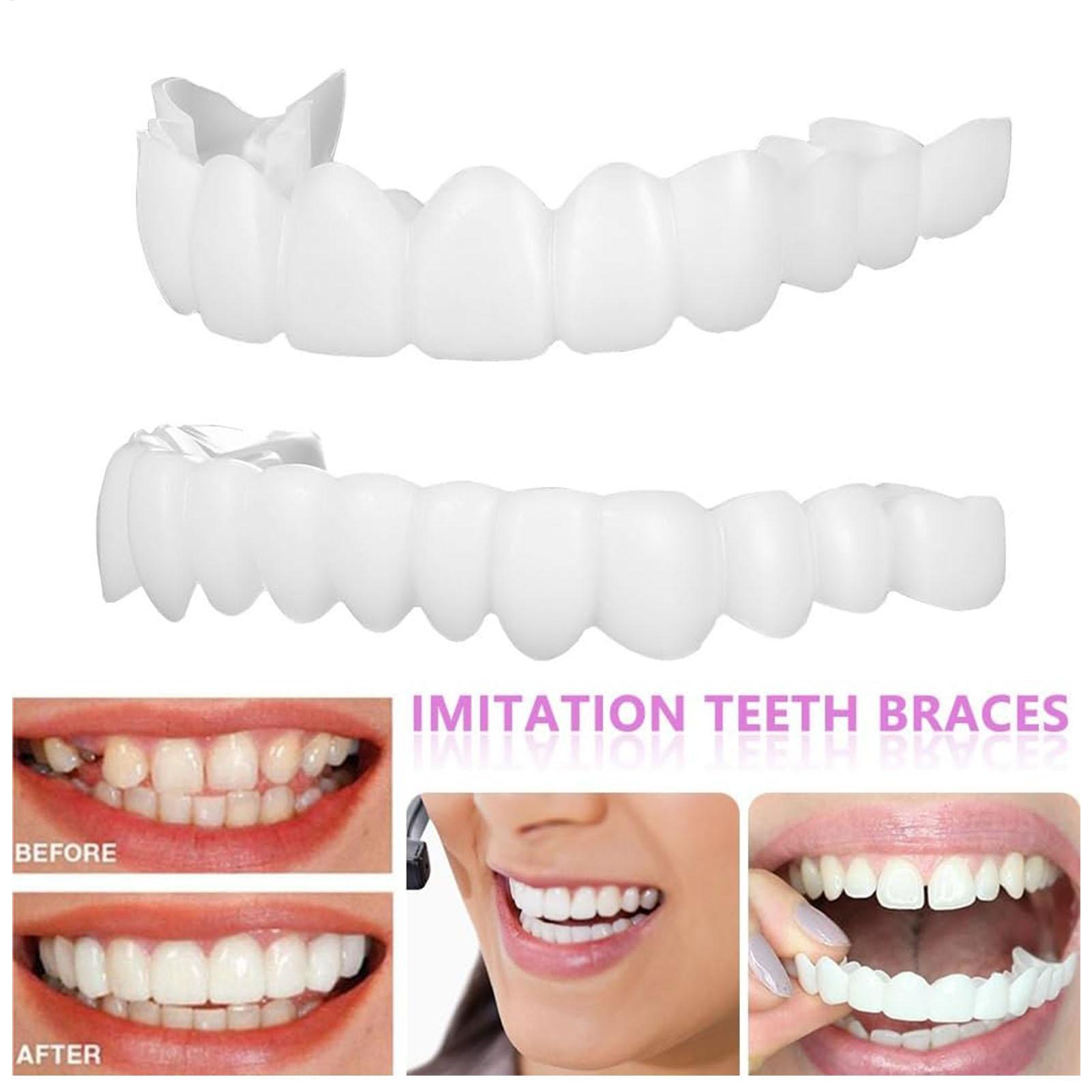 2pcs Men Women Temporary Teeth - Teeth Whitening Veneers recension och pris