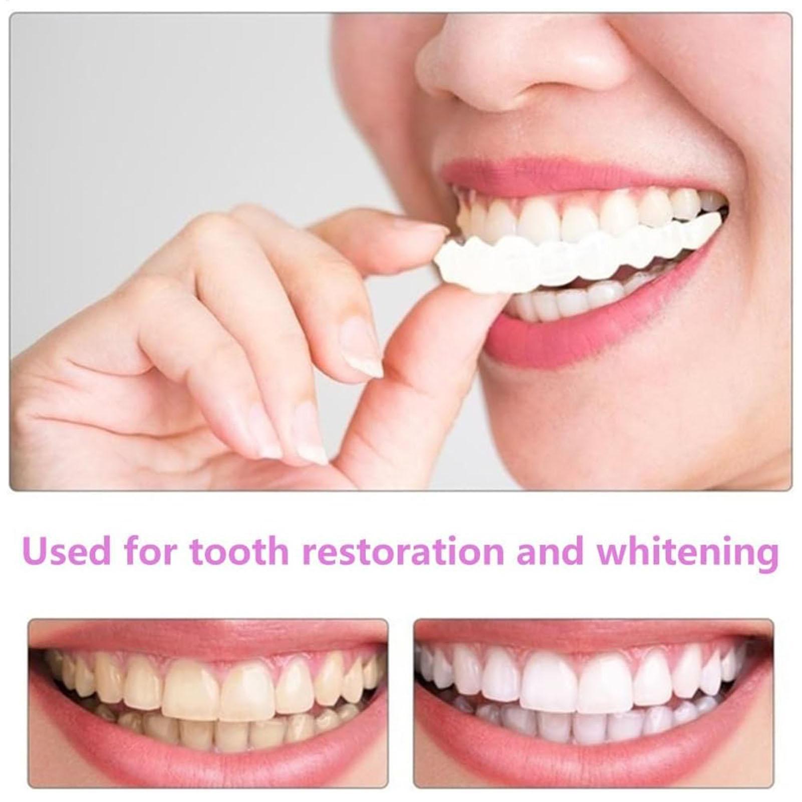 2pcs Men Women Temporary Teeth - Teeth Whitening Veneers recension och pris