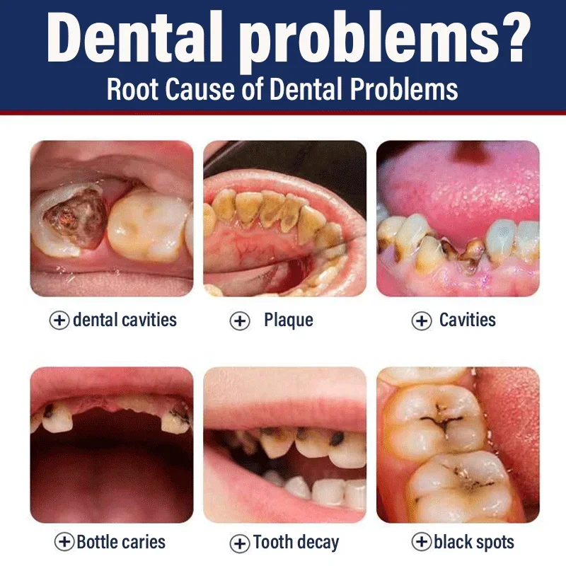 2025 Remove Cavities Effective - Teeth Whitening Effective recension och pris