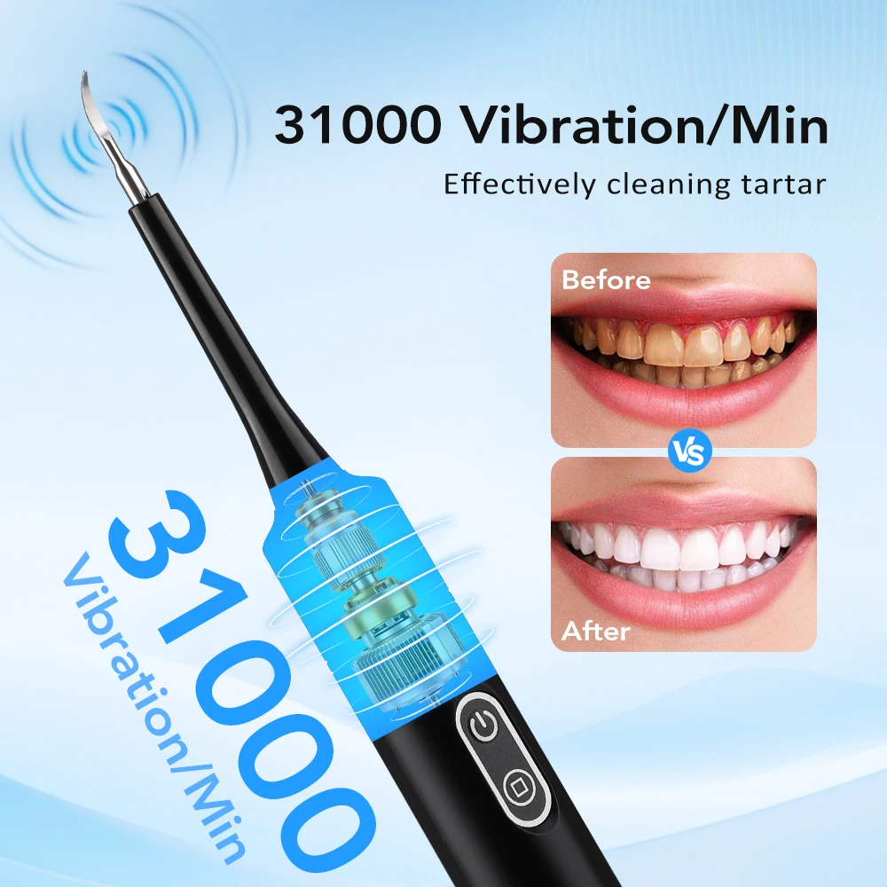 Electric Sonic Vibration Denta - Teeth Whitening Kit Professional recension och pris